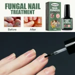 Ying59 Nail Fungal Treatment Essence Oil Foot Toe Nail Fungus Removal Serum 7 Days Repair Onychomycosi Anti Infection Gel Care