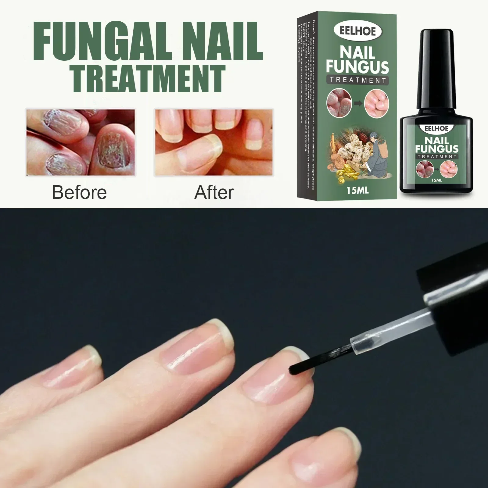 kf-Sa08dc8adb3ee4f50b184ee4f1b41088cm Ying59 Nail Fungal Treatment Essence Oil Foot Toe Nail Fungus Removal Serum 7 Days Repair Onychomycosi Anti Infection Gel Care - Image 1