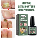 Nail Fungal Treatment Essence Oil Foot Toe Nail Fungus Removal Serum 7 Days Repair Onychomycosi Anti Infection Gel Care Products - Image 2